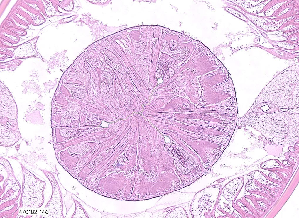 <i>Ascaris lumbricoides</i> Slide