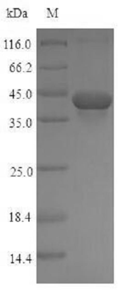 Rat Recombinant TGF beta 1 (from E. coli) | VWR, part of Avantor