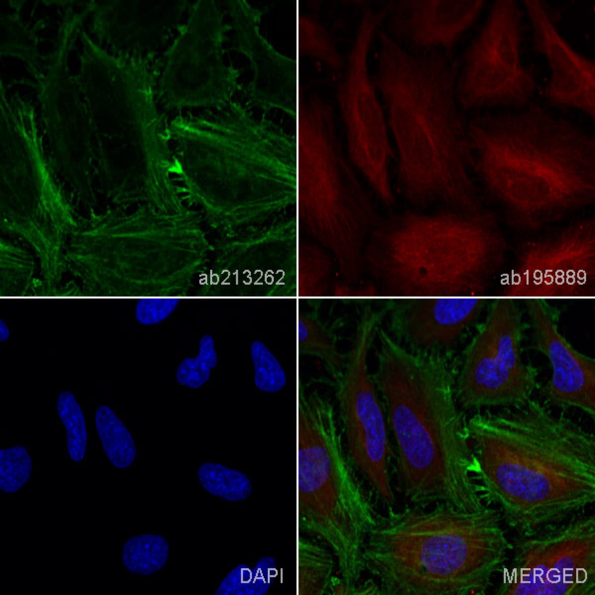 Anti-beta Actin Rabbit Monoclonal Antibody [clone: EPR21241] | VWR ...
