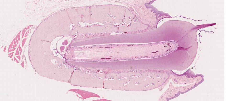 Tooth Development Slides