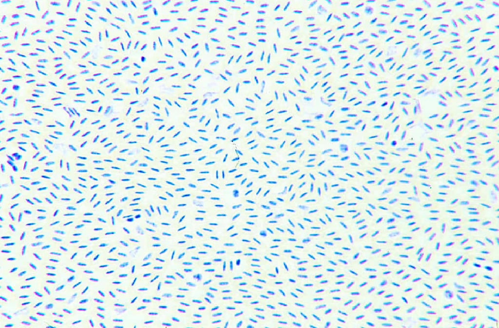 Bird Blood Slide