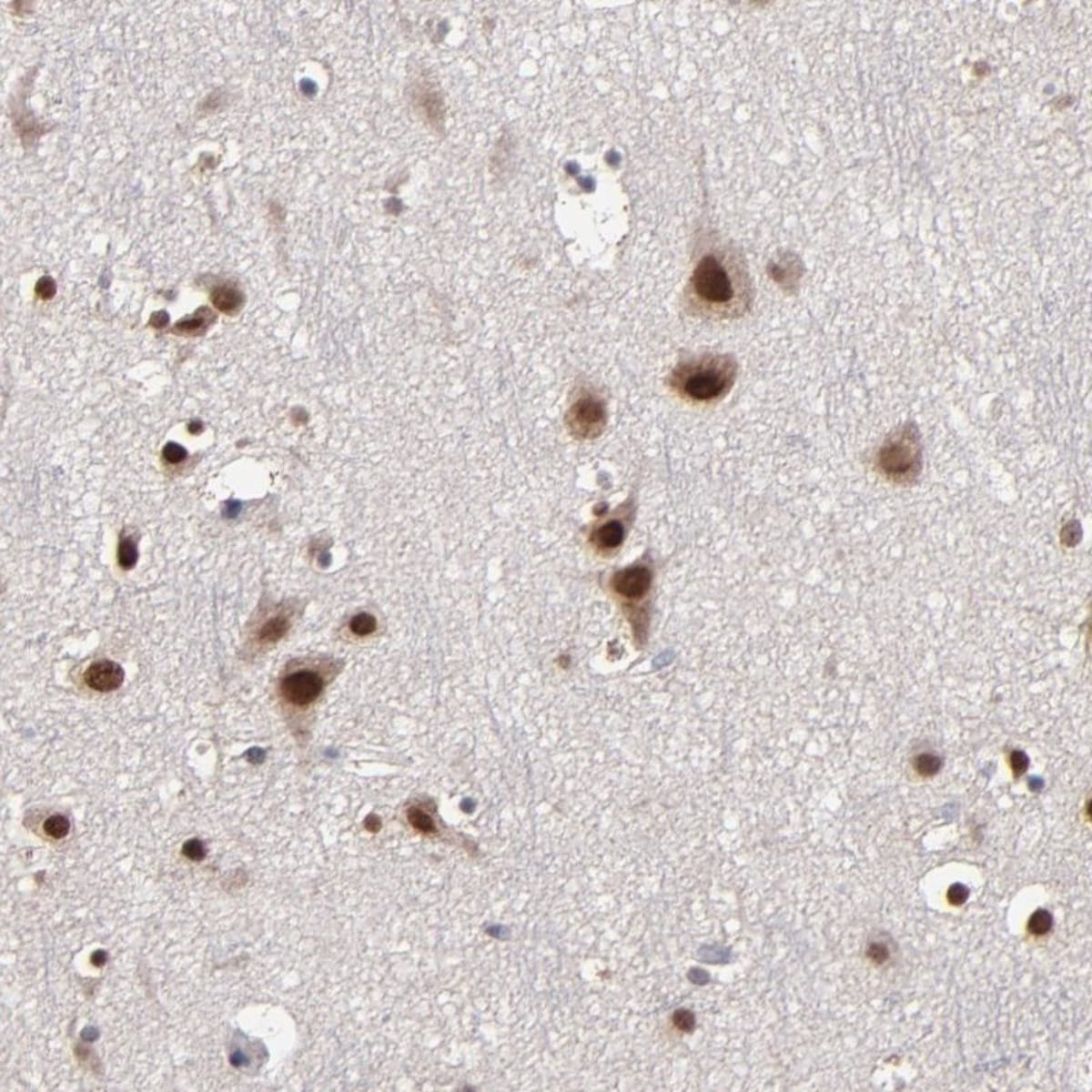 Anti-NPAS3 Rabbit Polyclonal Antibody | VWR, part of Avantor