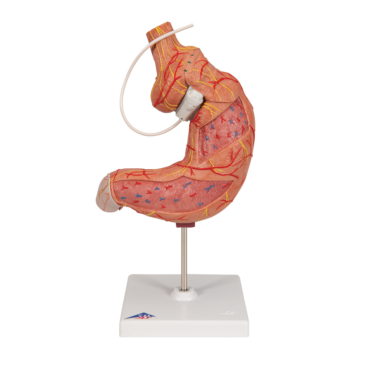 3B Scientific® Gastric Band Model