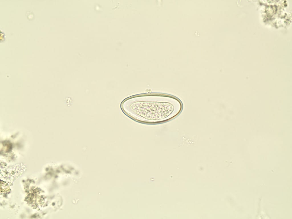 Enterobius vermicularis, Eggs Slide