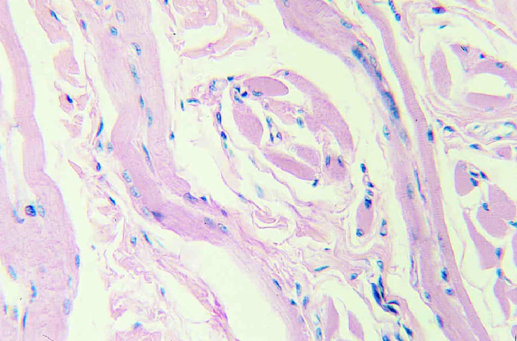 Skeletal Muscle, Human Slide