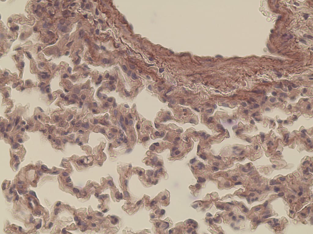 Lung Slide