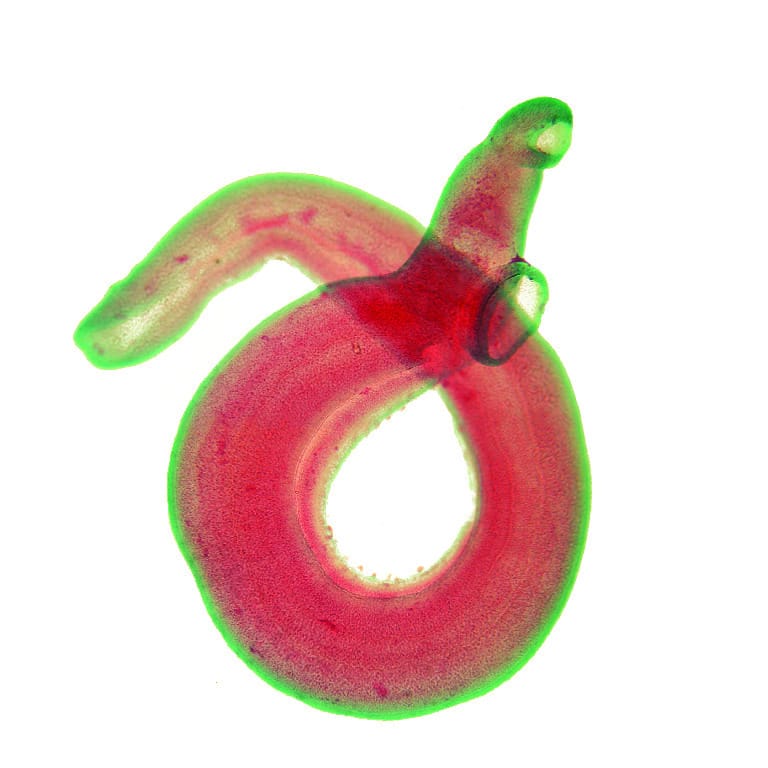 Schistosoma haematobium, Male Slide
