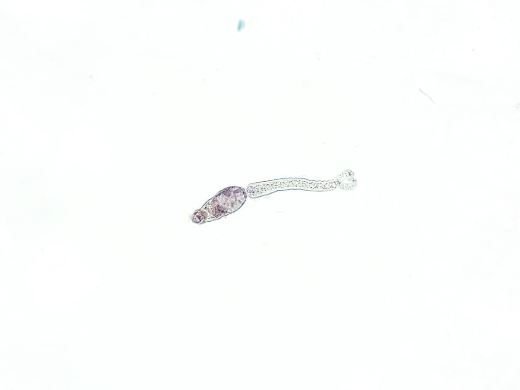 Schistosoma mansoni, Cercaria Slide