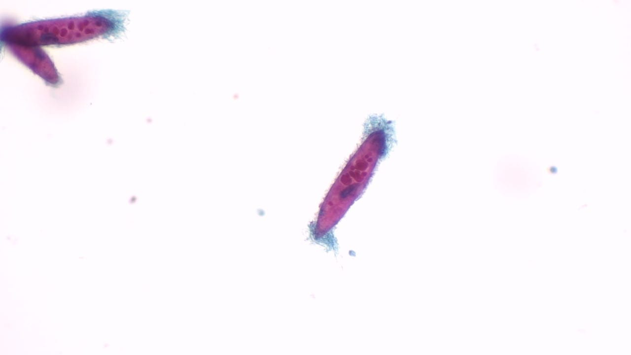 Paramecium, Four Types Slide