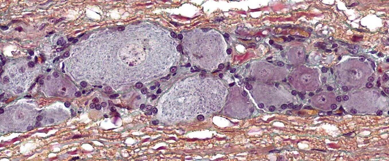 Spinal Ganglion Slide