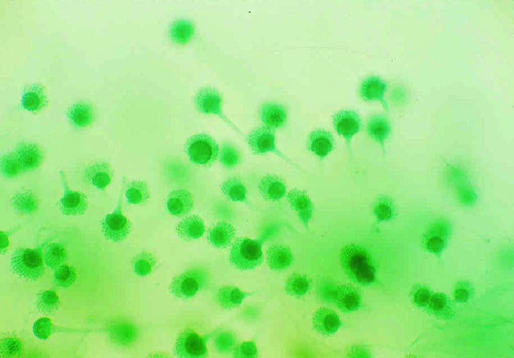 Aspergillus, Conidiophores