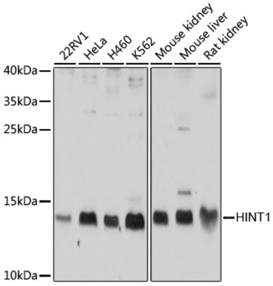 Anti-NAPRT Rabbit Polyclonal Antibody | VWR, part of Avantor