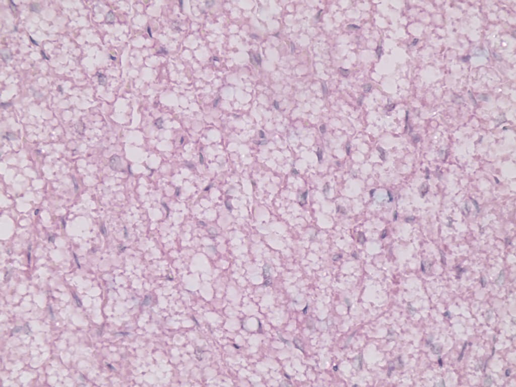 Brown Adipose Tissue Slide