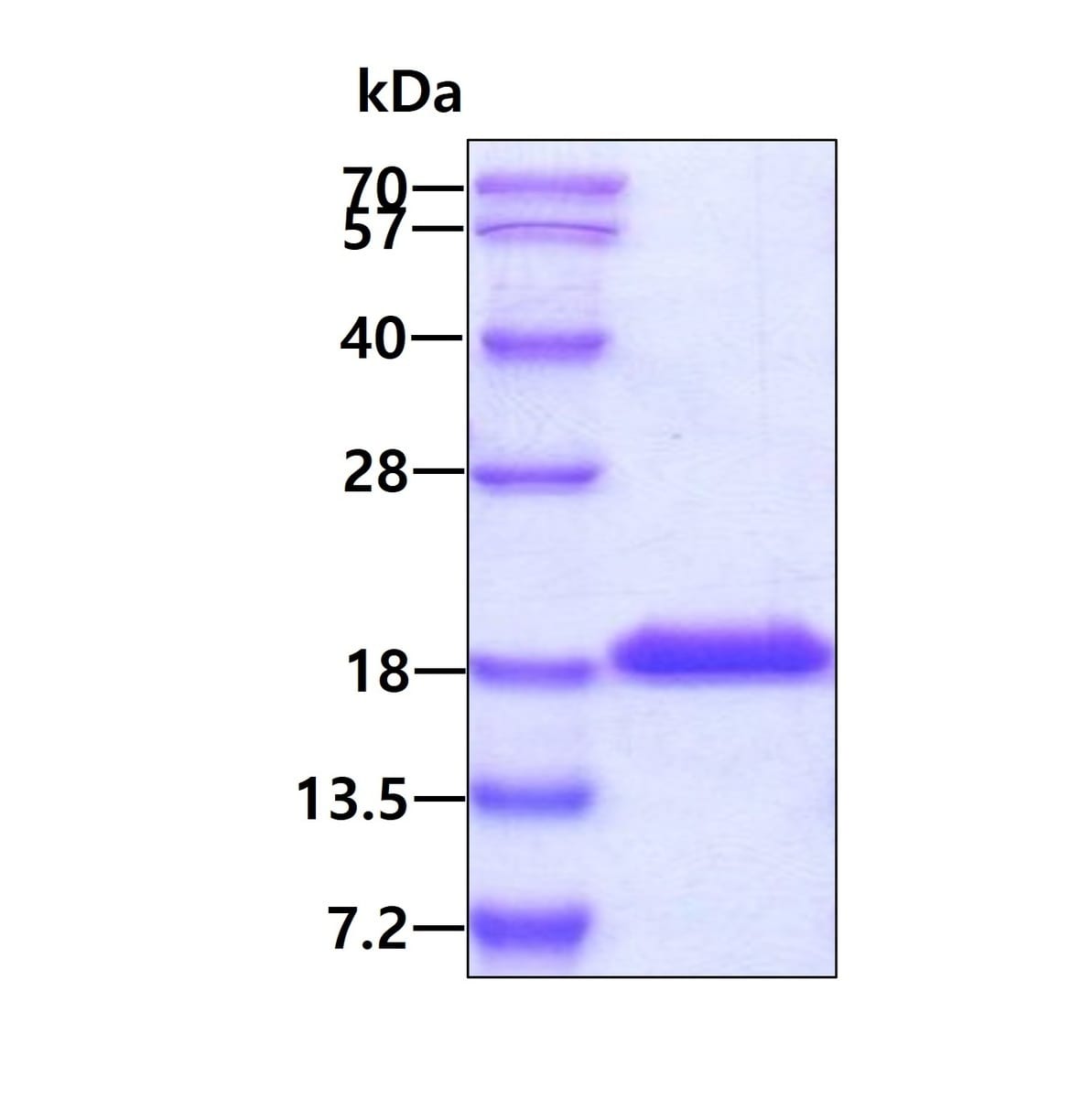 Human Recombinant IL-1F10 (from E. coli) | VWR, part of Avantor