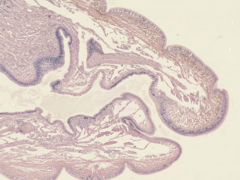 Earthworm, Anterior Region Slide