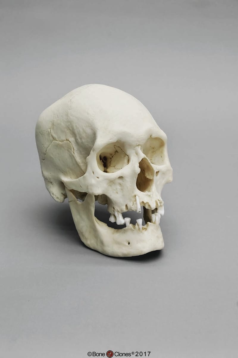 BoneClones® Regional Human Skulls