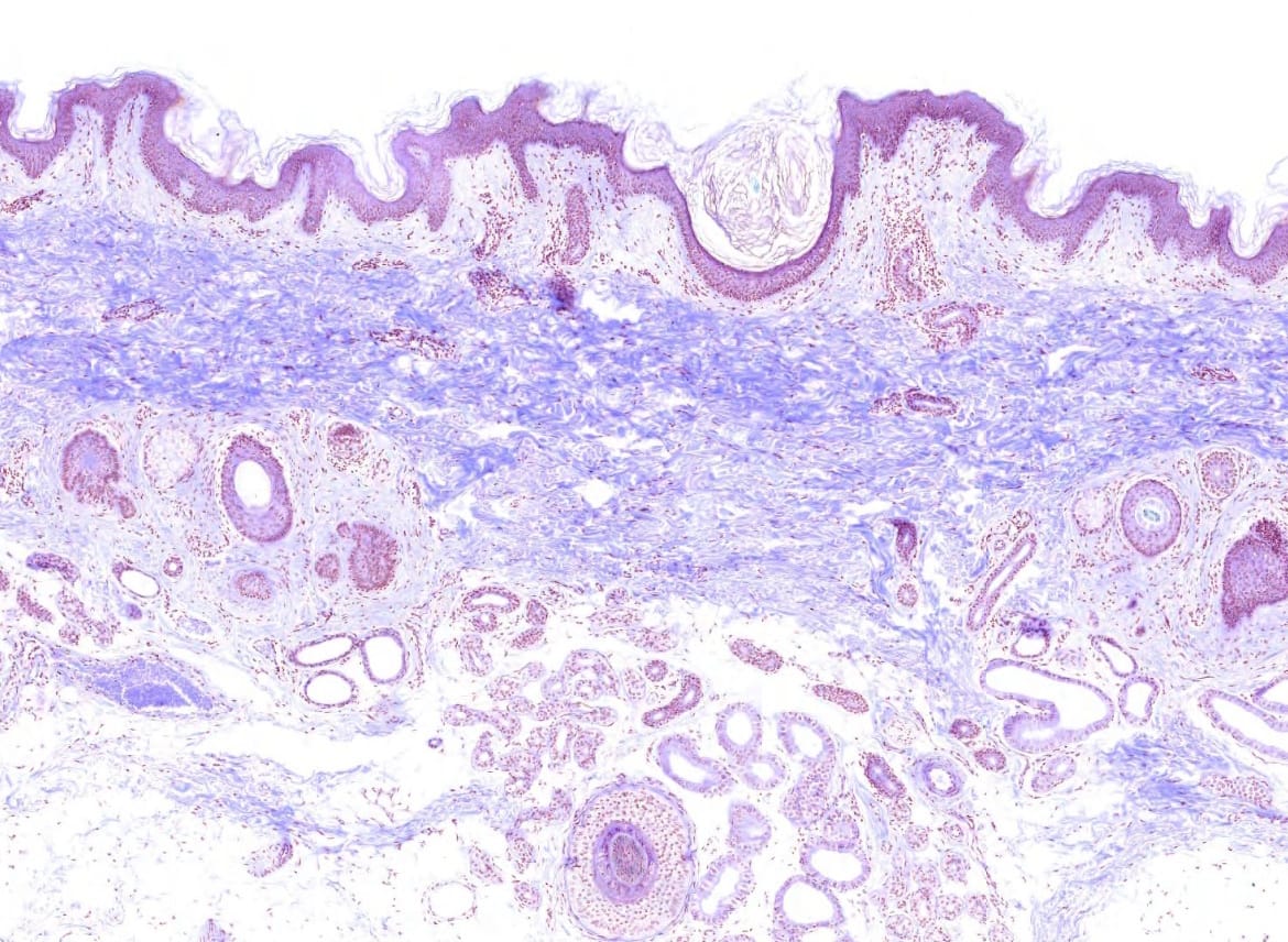 Axillary Skin Slide