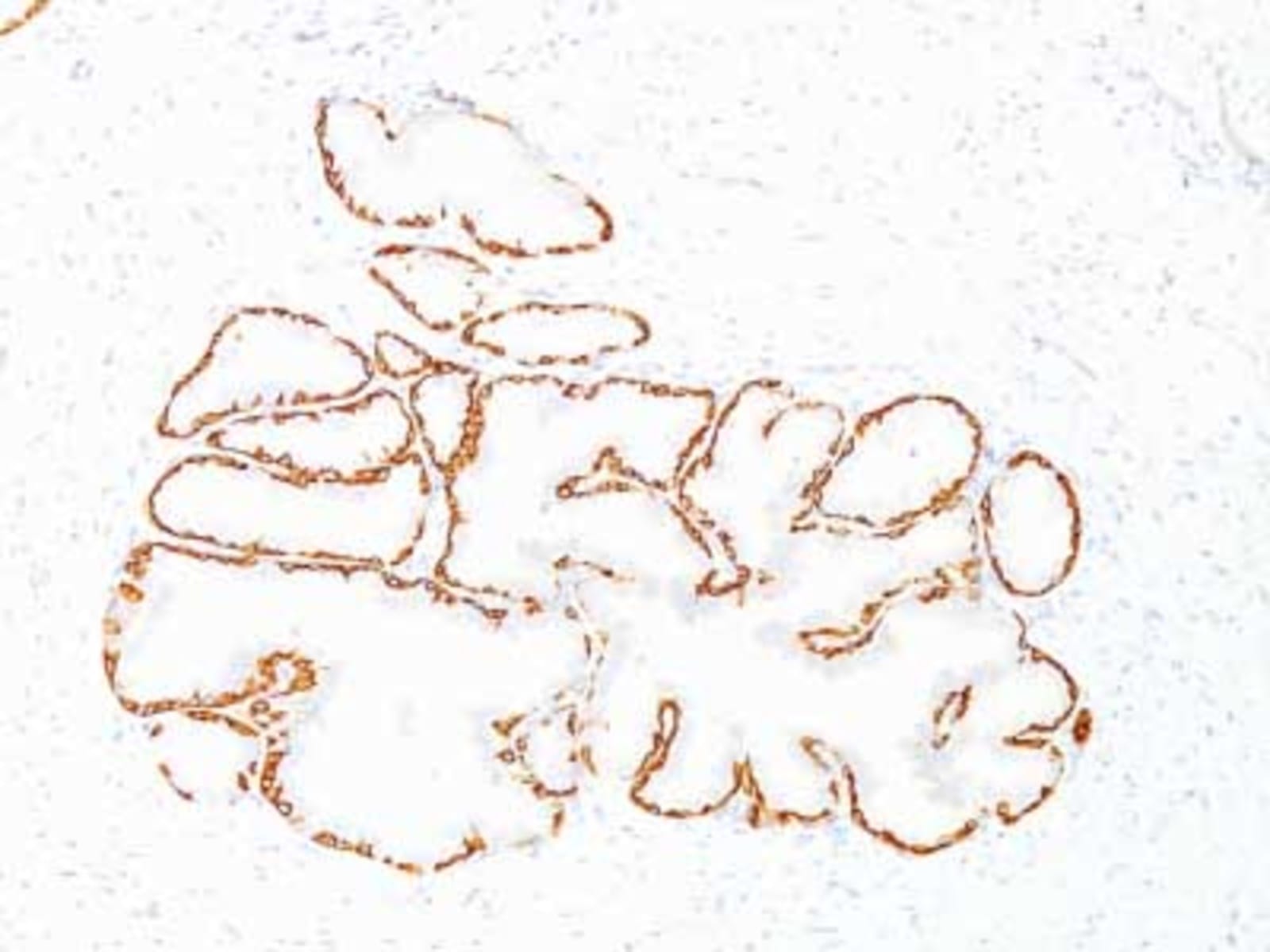 Anti-Cytokeratin 14 Mouse Monoclonal Antibody [clone: SPM263] | VWR ...
