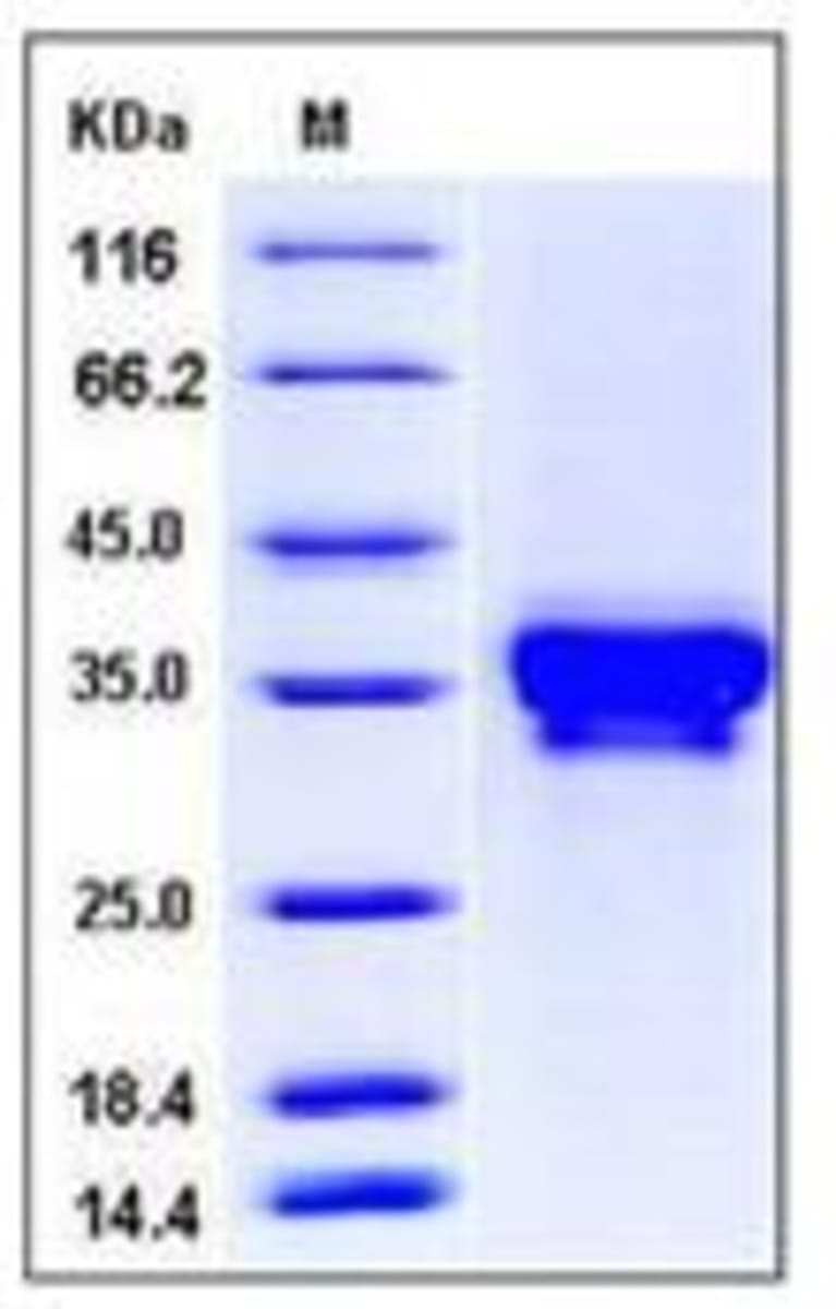 Human Recombinant Stromal interaction molecule 1 (from HEK293 cells ...