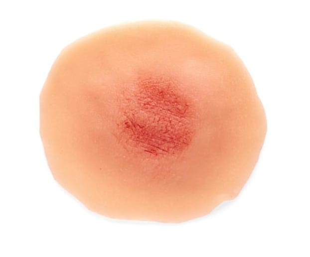 Medicor® Sticky Wounds