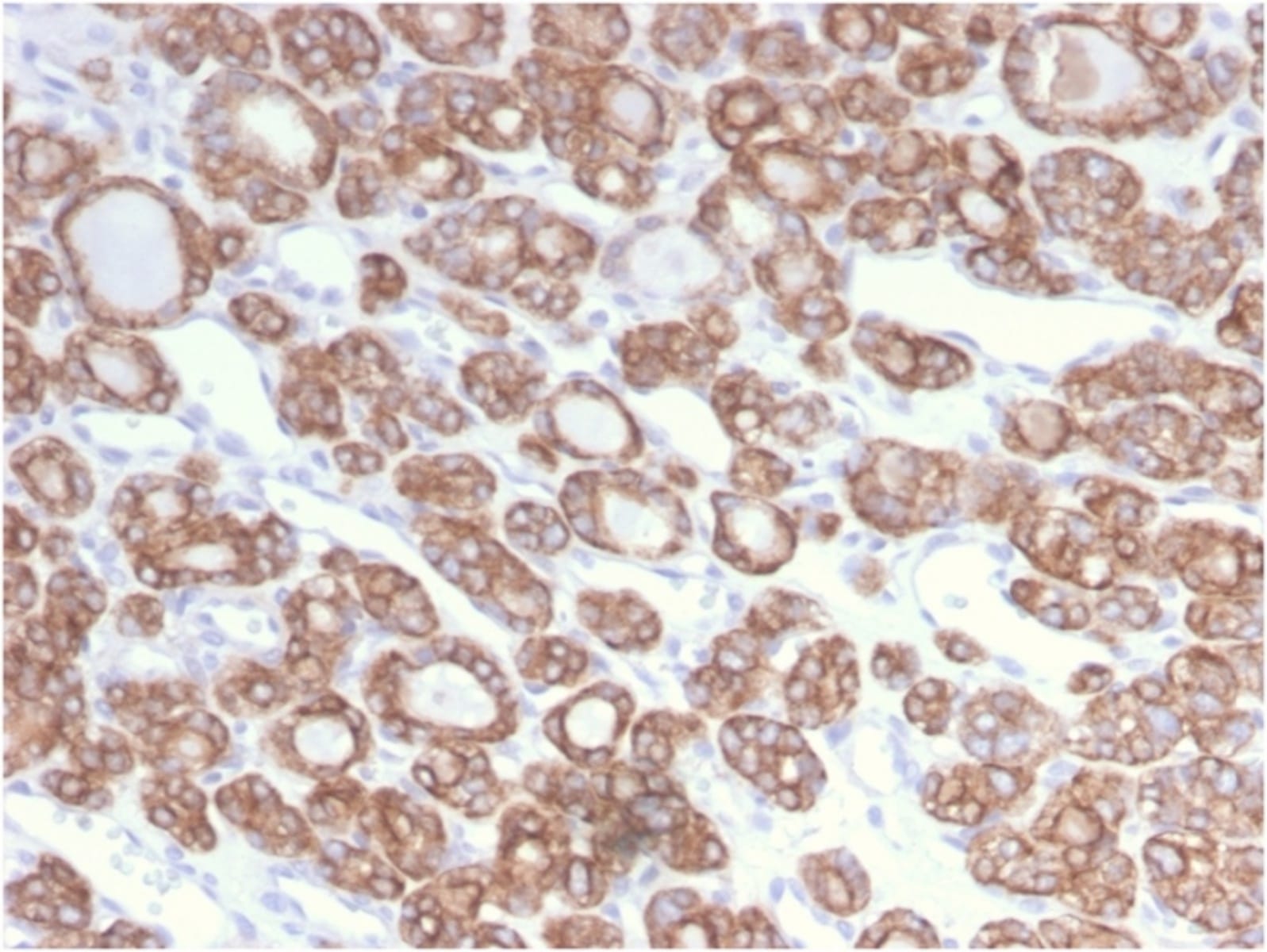 Anti-Cytokeratin 18 Rabbit Recombinant Antibody [clone: KRT18/2808R ...