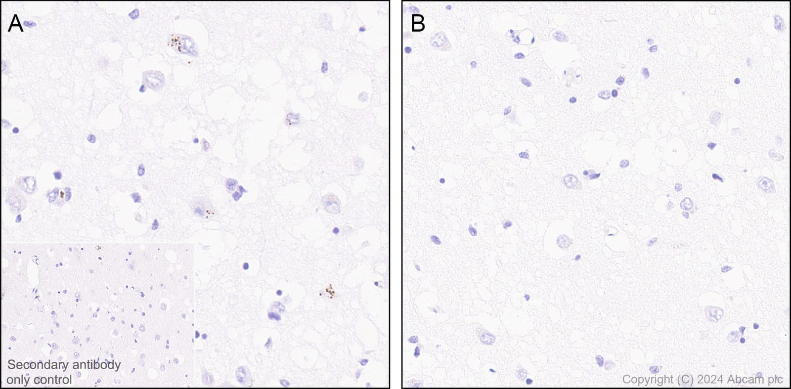 Anti-Ubiquitin (phospho S65) Rat Monoclonal Antibody [clone: 41H1/41K3 ...