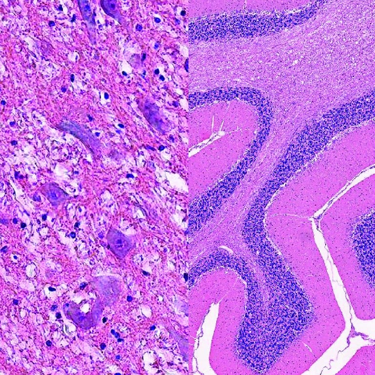 Brain, Composite Slide