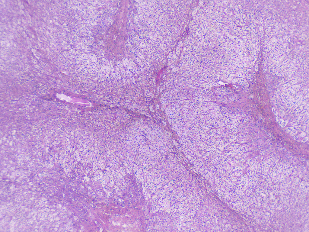Adrenal Gland, Human Slide