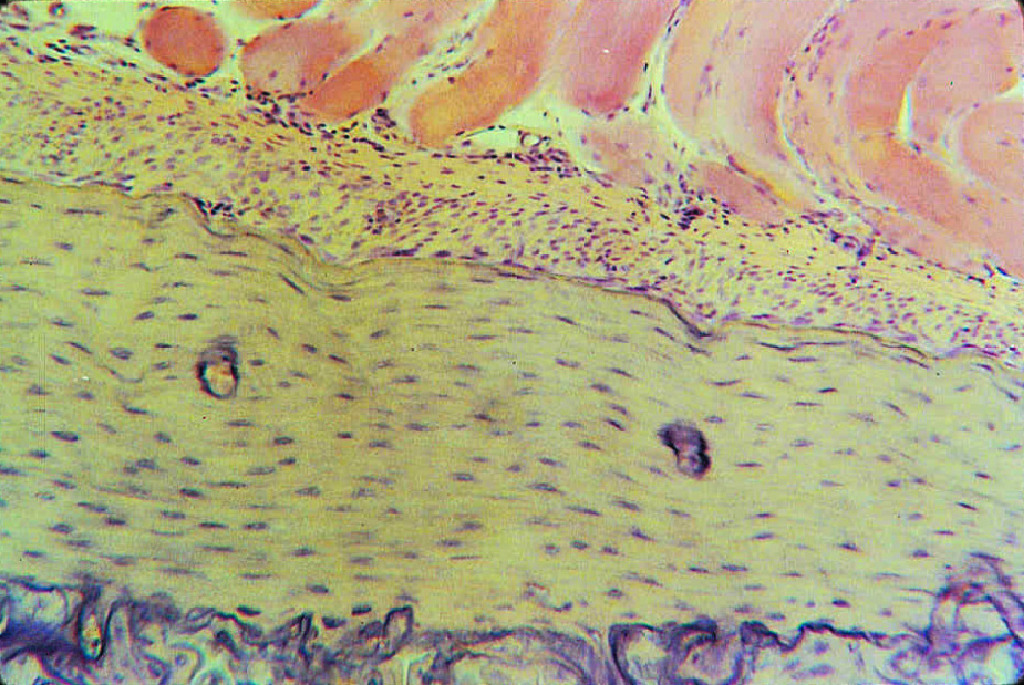 Bone, Compact Slide