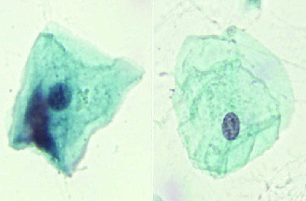 Barr Bodies, Male/Female Comparison Slide