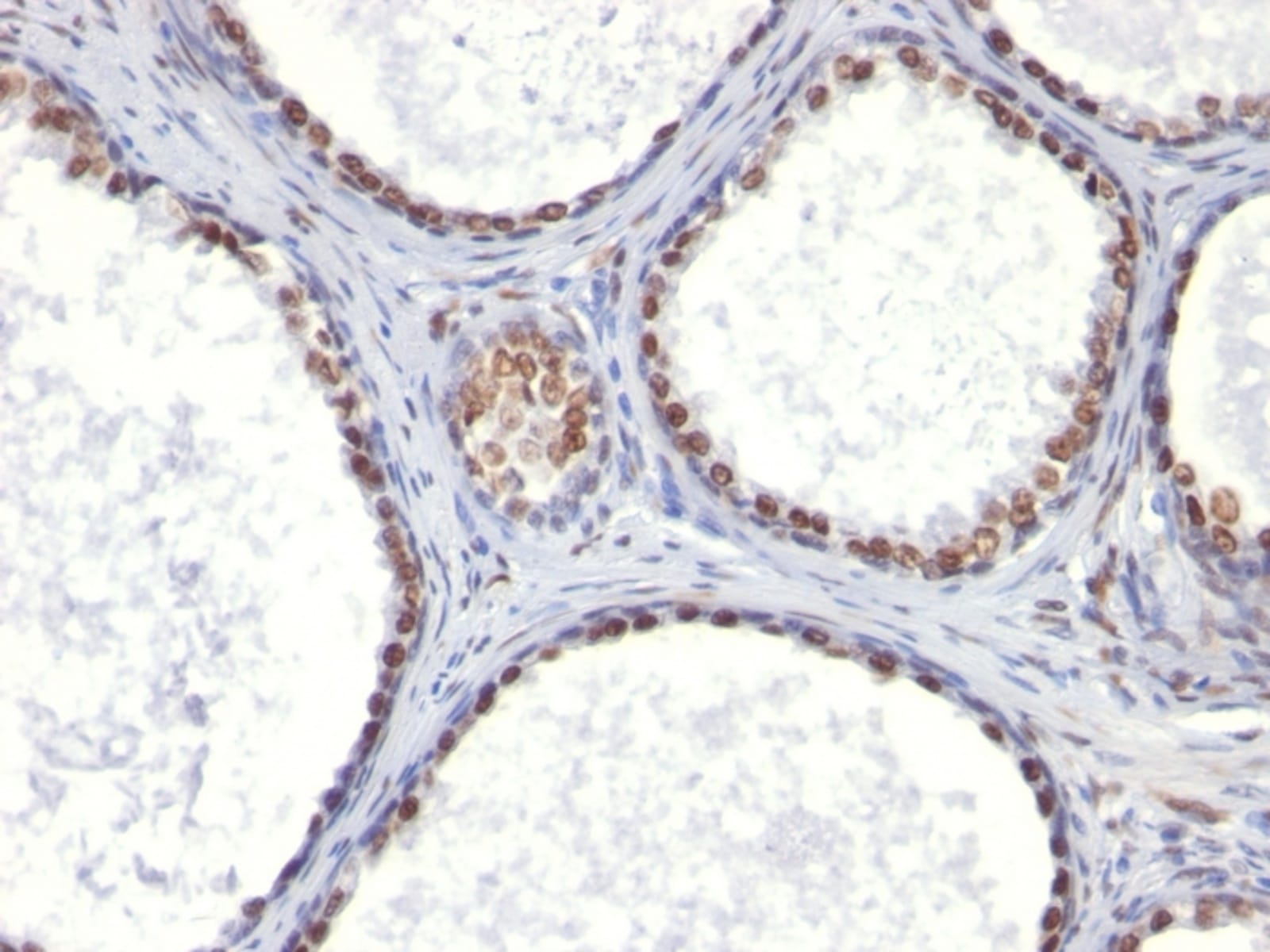 Anti-Androgen Receptor Mouse Monoclonal Antibody [clone: AR441] | VWR ...
