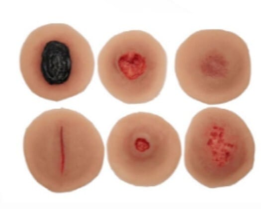 Medicor® Sticky Wounds