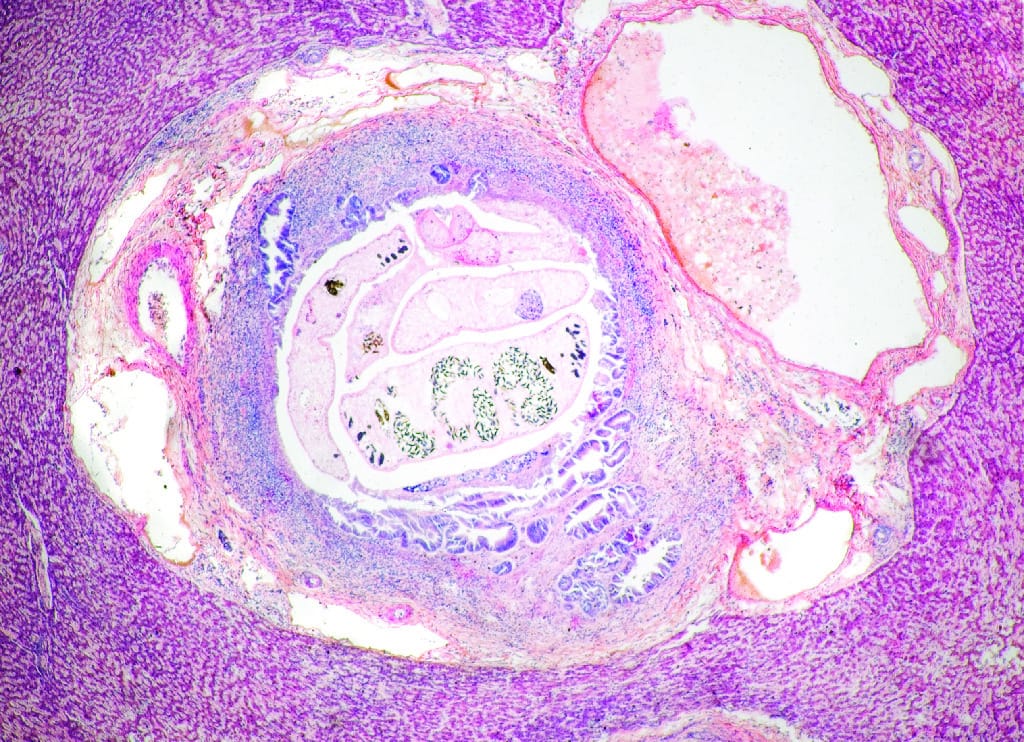 Clonorchis sinensis Slide