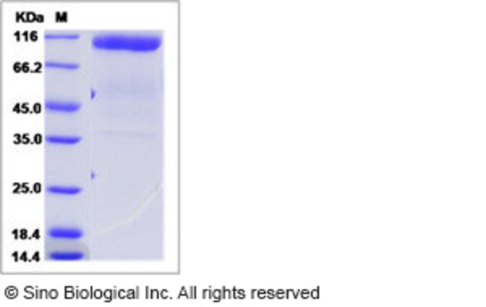 Human Recombinant Gliomedin/GLDN Protein (Fc Tag, ECD) (from HEK293 ...