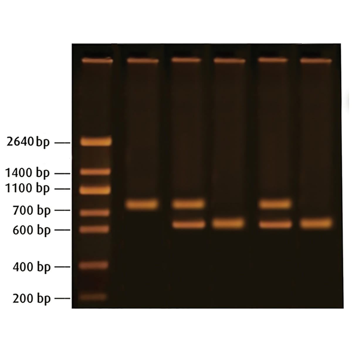 Edvotek Diagnosing Huntington's Using PCR