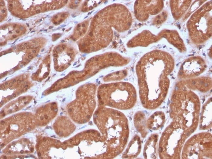 Anti-MTAP Rabbit Recombinant Monoclonal Antibody [clone: MTAP/3137R ...