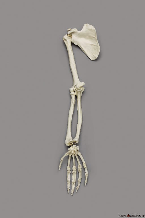 BoneClones® Limbs for Anatomical Comparison