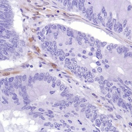 Anti-PTEN Rabbit Monoclonal Antibody [clone: SP218] | VWR, part of Avantor