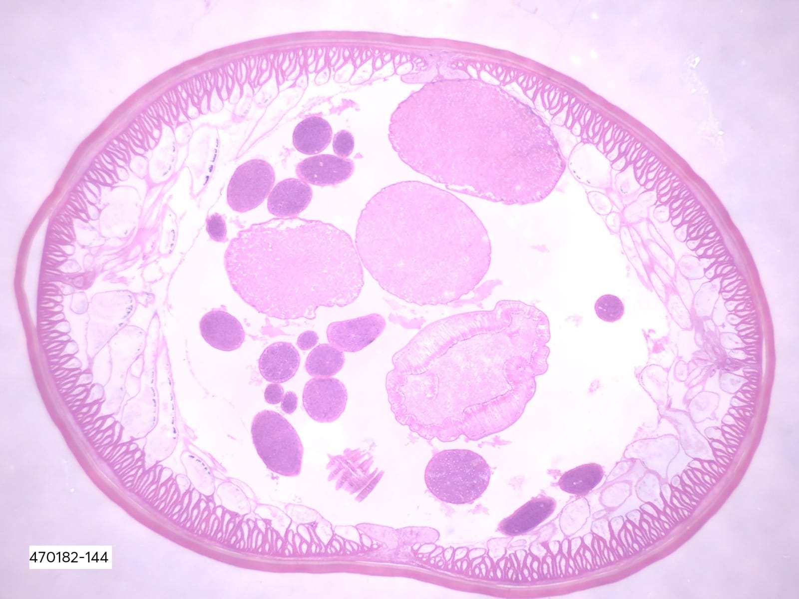 <i>Ascaris lumbricoides</i> Slide
