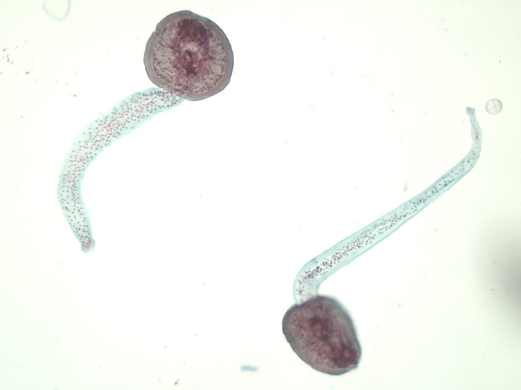 Fasciola hepatica, Cercaria Slide