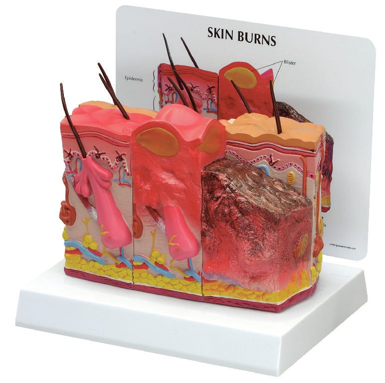 GPI Anatomicals® Skin Health Models