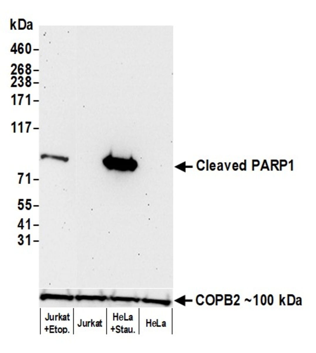 Anti-PARP1 Rabbit Monoclonal Antibody [clone: BLR183J] | VWR, part of ...