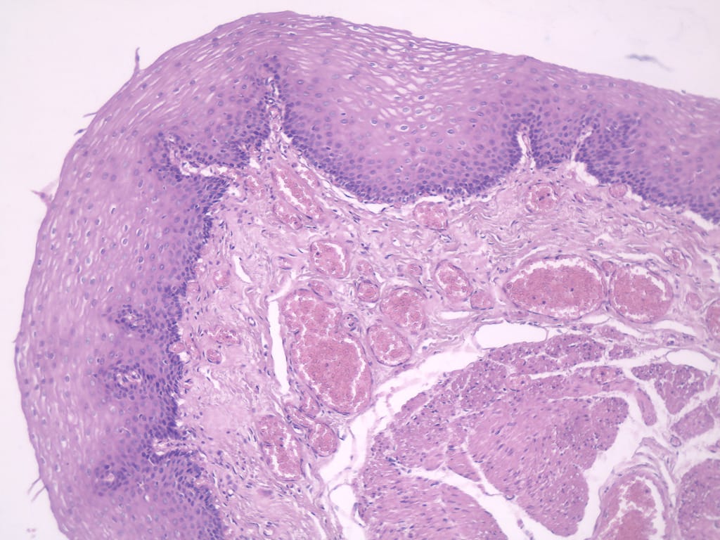 Esophagus, Composite Slide
