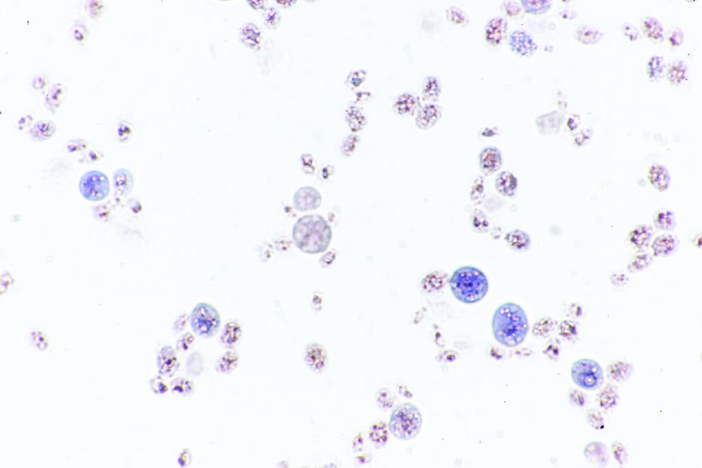 Saccharomyces, Budding Cells Slide