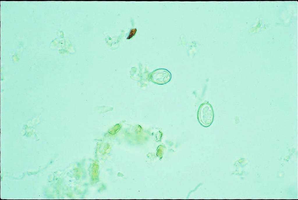 Eimeria sp., Oocysts Slide