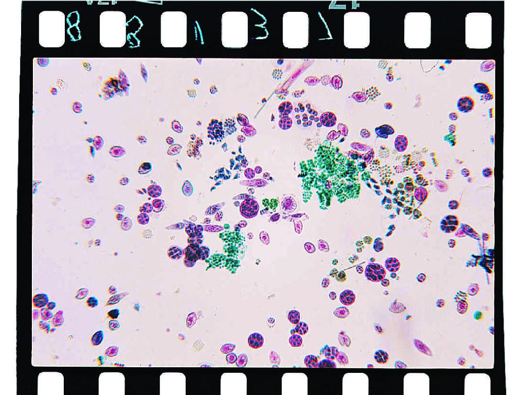 Mixed Flagellates Slide
