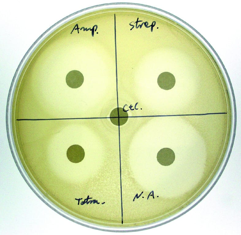Antibiotic Sensitivity and Bacteria Activity Kit
