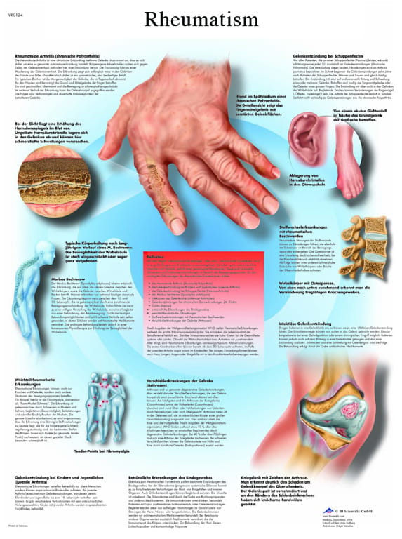 3B Scientific® Rheumatism Chart