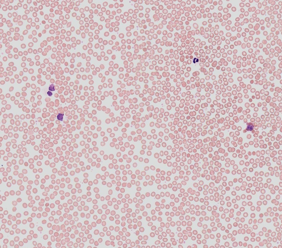 Human Blood Slide