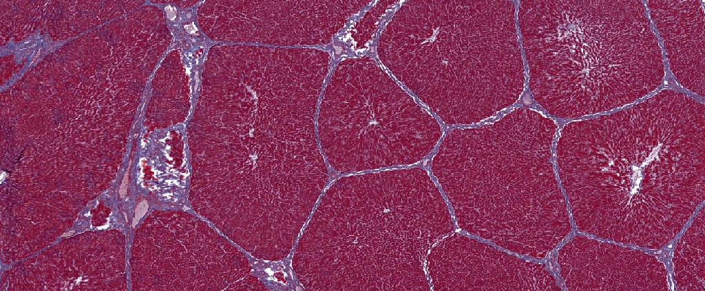 Liver Slide
